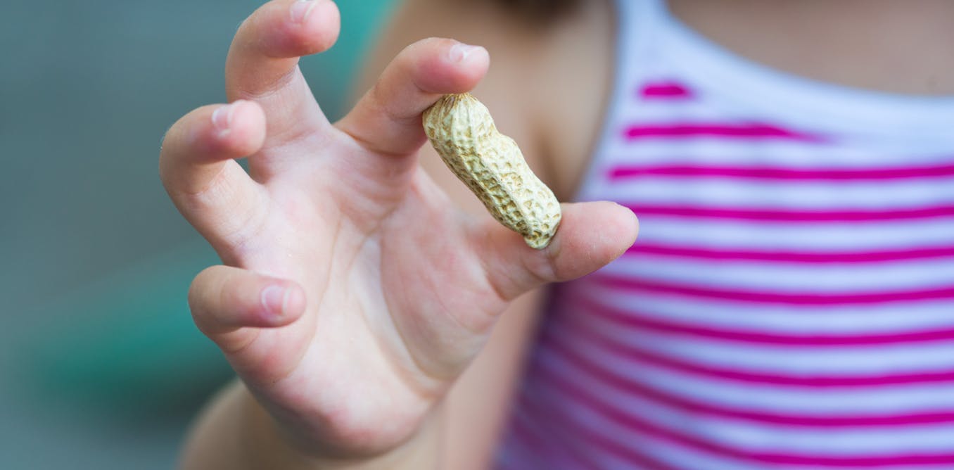 webnexttech | What’s behind the large rise in food allergies among children in the UK?